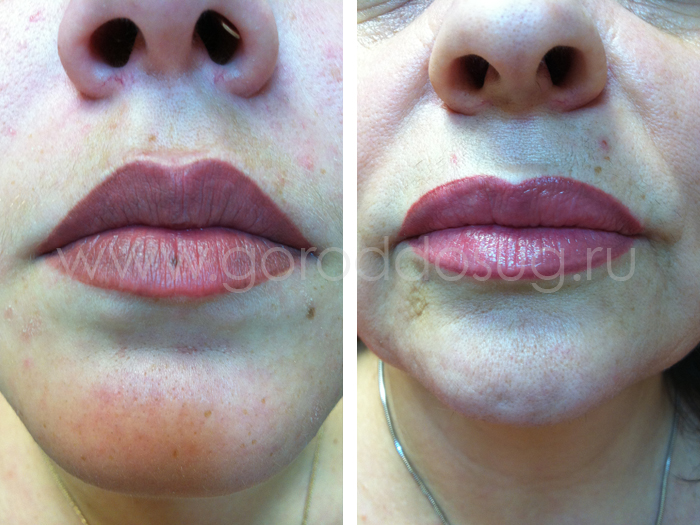 ������ ������� "Elen Esthetics"