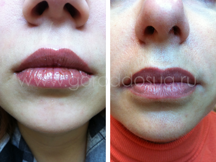 ������ ������� "Elen Esthetics"
